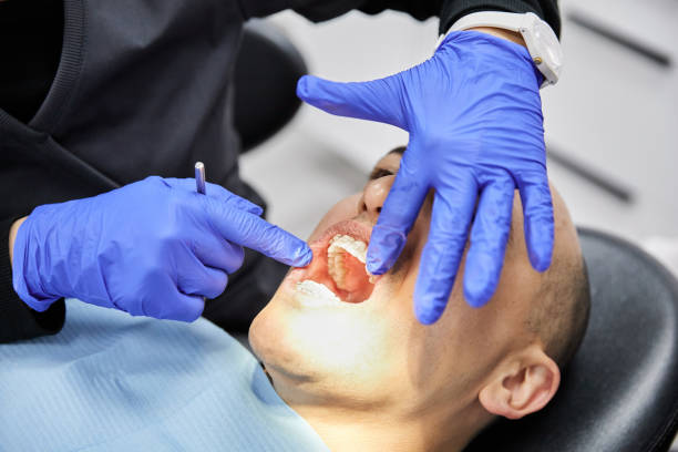 Best Emergency Wisdom Tooth Extraction in Edgefield, SC