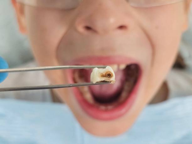 Best Emergency Pediatric Dental Care in Edgefield, SC